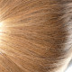 Perruque et prothèse capillaire pour cancer, Sécurité Sociale et la Mutuelle - Emaliz Hair